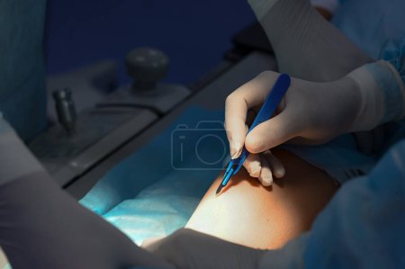 Photo for The doctor makes a cut on the leg with a scalpel. High quality photo - Royalty Free Image