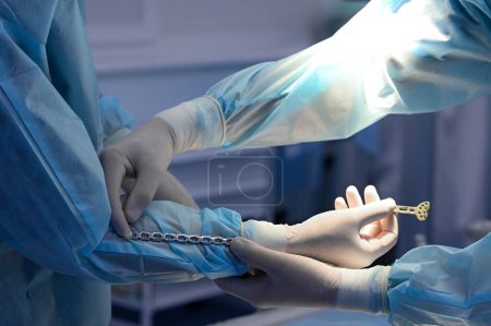 Ärzte entscheiden sich für orthopädische Schrauben und Bolzen für Operationen. Nahaufnahme.Hochwertiges Foto