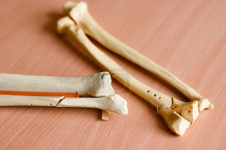 Models of the radial bones of the hand. High quality photo