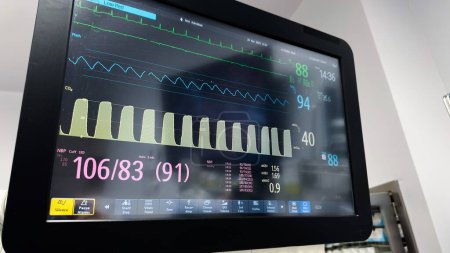 Foto de Máquina de anestesia hospitalaria con equipo médico adjunto, como manguito de presión arterial, sonda de temperatura y monitor de frecuencia cardíaca. Simbolizando la importancia de monitorear los signos vitales durante el tratamiento médico - Imagen libre de derechos