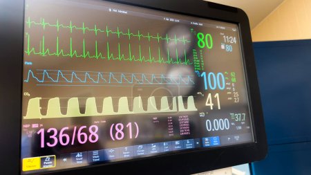 Foto de Máquina de anestesia hospitalaria con equipo médico adjunto, como manguito de presión arterial, sonda de temperatura y monitor de frecuencia cardíaca. Simbolizando la importancia de monitorear los signos vitales durante el tratamiento médico - Imagen libre de derechos