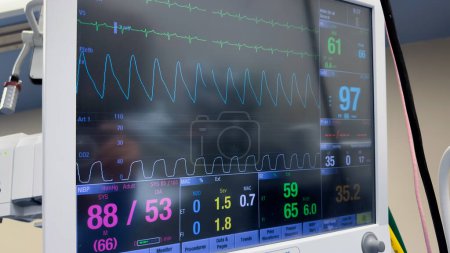 El monitor del hospital simboliza los signos vitales, la atención al paciente y la intervención médica: monitorización de la anestesia, la presión arterial, el pulso, la oxigenación, la ventilación y la frecuencia cardíaca para el bienestar del paciente.