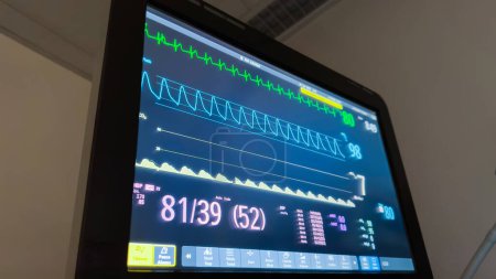 Foto de El monitor del hospital muestra signos vitales: temperatura, presión arterial, frecuencia cardíaca y oximetría de pulso. Simbolizar la salud, el bienestar y la atención médica - Imagen libre de derechos