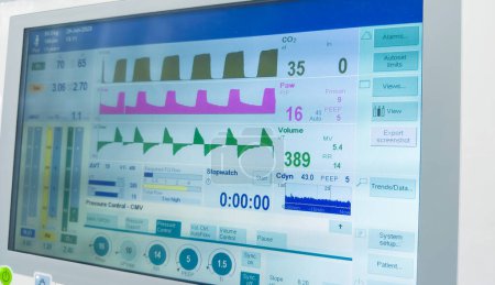 Foto de Monitor hospitalario que muestra signos vitales: frecuencia cardíaca, presión arterial, oximetría de pulso, temperatura. Simbolizar el monitoreo de la salud y la atención médica - Imagen libre de derechos