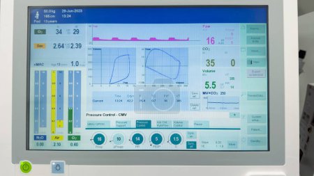 Foto de Monitor hospitalario que muestra signos vitales: frecuencia cardíaca, presión arterial, oximetría de pulso, temperatura. Simbolizar el monitoreo de la salud y la atención médica - Imagen libre de derechos