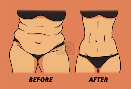 illustration de comparaison entre la graisse et le ventre idéal