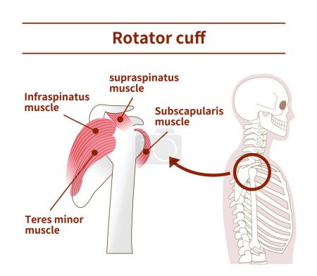 Ilustración de la anatomía del manguito rotador desde el costado