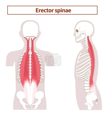 Téléchargez les illustrations : Illustration de l'anatomie du muscle érecteur spinae du côté et du dos - en licence libre de droit