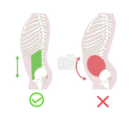 Ilustración de Ilustración diagramática de la relación entre los grupos musculares abdominales, la presión abdominal y la postura, de lado - Imagen libre de derechos