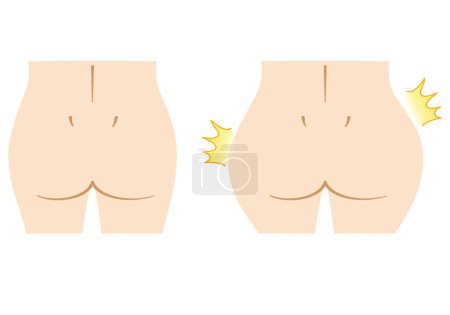 Clip art of woman's buttock Beauty Aesthetic