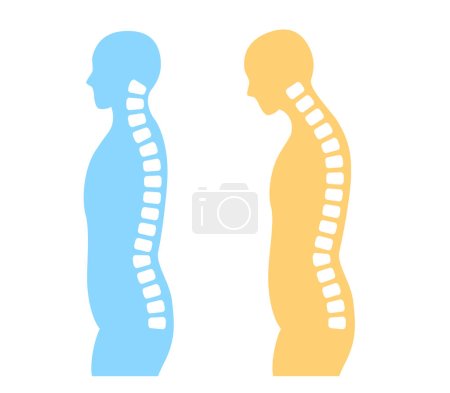 Ilustración de cuello recto y columna cervical