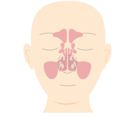 Ilustración de Ilustración de la cabeza con vista frontal de los senos paranasales - Imagen libre de derechos