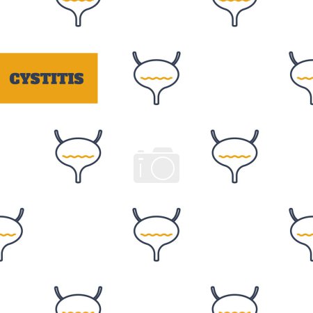 Illustration for Cystitis. Bladder inflammation problem. Urinary tract infection. Urologic disease awareness pattern. Human body anatomy concept. Medical vector illustration. - Royalty Free Image