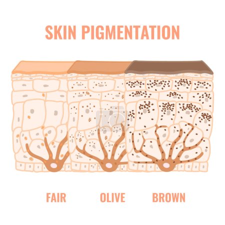 Contenido y distribución de melanina en diferentes fototipos de tono de piel. Mecanismo de pigmentación en piel oscura, oliva y clara. Epidermis cross-section infographic medical diagram. Ilustración vectorial.