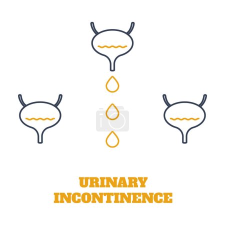 Illustration for Urinary incontinence condition. Loss of bladder control. Urologic disease awareness pattern. Human body anatomy concept. Medical vector illustration. - Royalty Free Image