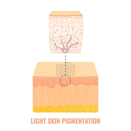 Illustration for Melanin content and distribution in light skin. Fair complexion pigmentation mechanism infographic diagram. Epidermis cross-section in closeup. Vector illustration. - Royalty Free Image