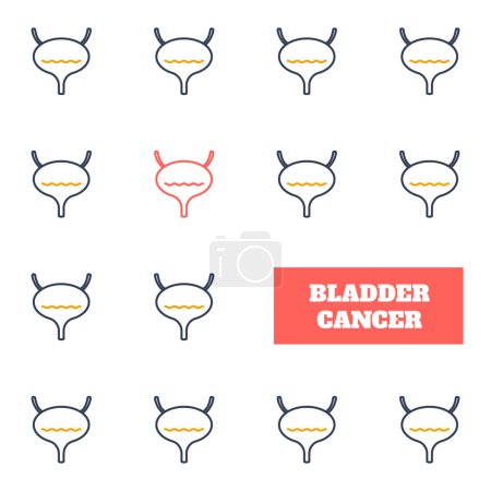 Illustration for Bladder cancer awareness pattern. Bladder lining tumour. Urinary tract disorder. Urologic disease. Human body anatomy concept. Medical vector illustration. - Royalty Free Image