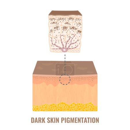 Illustration for Melanin content and distribution in dark skin phototype. Pigmentation mechanism infographic diagram. Epidermis cross-section in closeup. Vector illustration. - Royalty Free Image