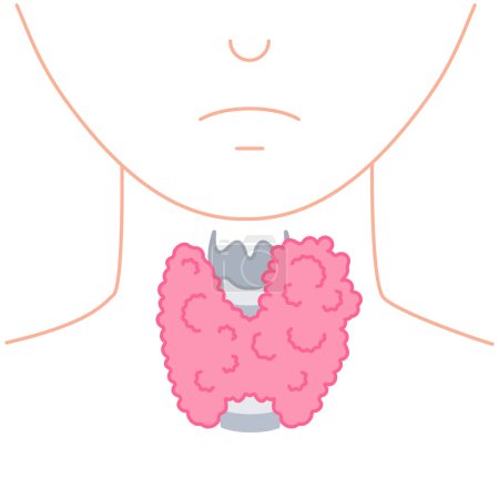 Illustration for Enlarged thyroid gland lobe icon. Faceless body silhouette. Thyroid hormones function support. Hyperthyroidism and hypothyroidism diseases. Metabolism control. Body anatomy. Vector illustration. - Royalty Free Image