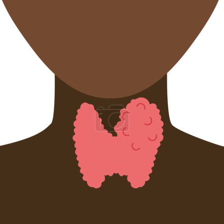 Illustration for Enlarged thyroid gland lobe icon. Black faceless body silhouette. Thyroid hormones function support. Hyperthyroidism and hypothyroidism diseases. Metabolism control. Body anatomy. Vector illustration. - Royalty Free Image