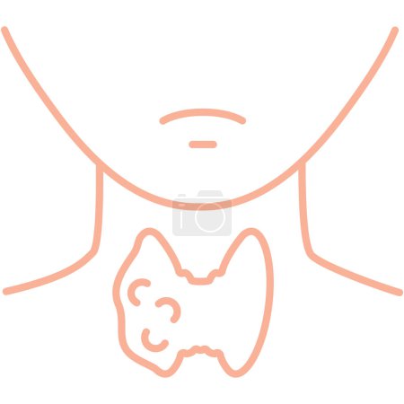 Illustration for Thyroid gland organ. Goiter nodules lumps. Outline body silhouette. Hypothyroidism and hyperthyroidism disorders therapy. Endocrinology medical concept. Isolated linear vector illustration. - Royalty Free Image