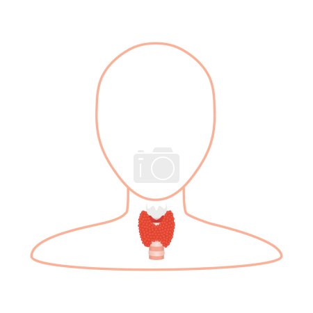 Illustration for Thyroid gland organ on body silhouette medical infographics. Hypothyroidism and hyperthyroidism disorders. TSH hormone disbalance therapy. Endocrinology concept. Isolated flat vector illustration. - Royalty Free Image