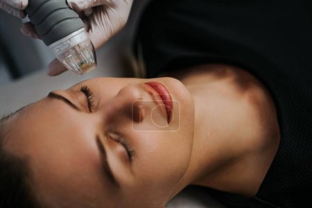 Photo for Microneedle RF lifting procedure. Hardware cosmetology. High quality photo - Royalty Free Image