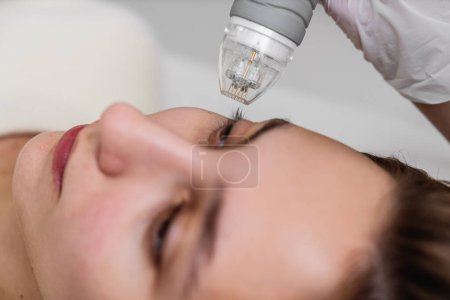 Téléchargez les photos : Une femme subit un traitement laser sur l'œil, avec l'aide d'un spécialiste assurant la sécurité et la précision. - en image libre de droit