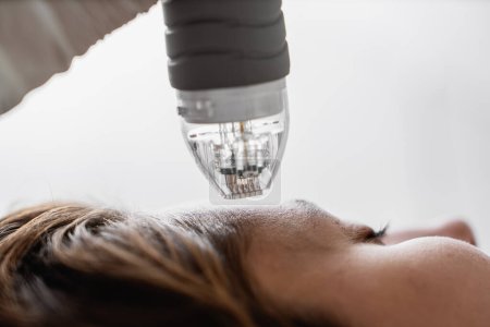 Téléchargez les photos : Une femme reçoit un traitement laser sur son visage pour améliorer son teint et son apparence. - en image libre de droit
