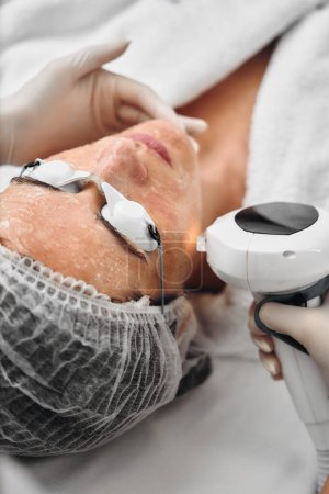A woman receives IPL therapy in a beauty salon. High quality photo