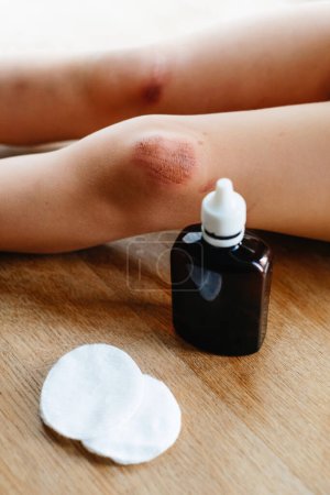 Photo for Helping a child perform first aid knee injury after she had an accident. Using antiseptic chlorhexidine, no pain - Royalty Free Image