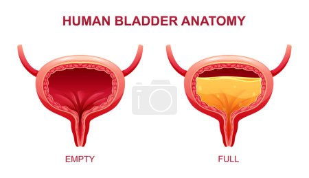 Illustration for Human bladder anatomy. Empty and full urinary bladder. Vector illustration isolated on white background - Royalty Free Image