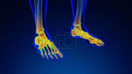 Photo for Human foot pain medical background - Royalty Free Image
