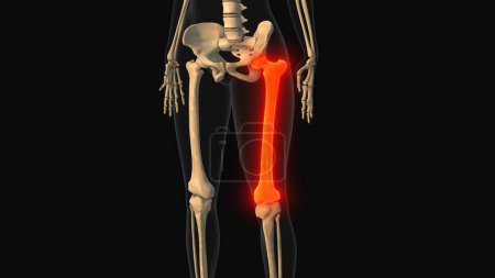 Foto de Animación médica del dolor óseo del fémur - Imagen libre de derechos