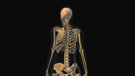 Foto de Animación médica del dolor óseo de la columna vertebral - Imagen libre de derechos