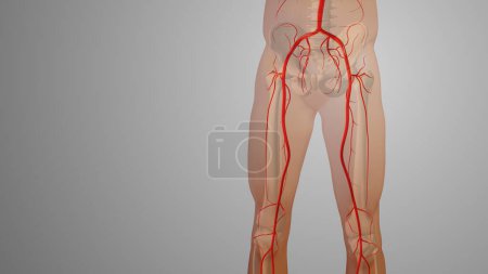 Photo for Peripheral artery bypass surgery medical animation - Royalty Free Image
