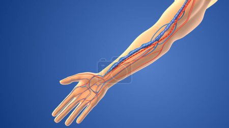 Photo for Medical animation of the Arteriovenous fistula - Royalty Free Image
