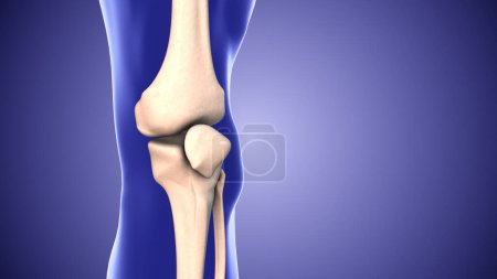 Knieschmerzen und die Lücke in den Kniegelenken