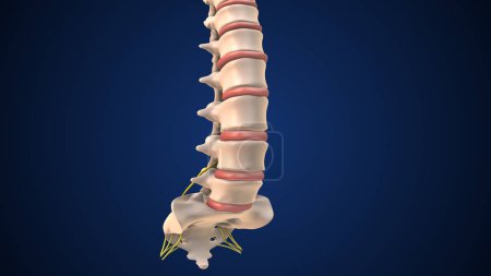 Foto de Animación médica de una hernia discal en la columna lumbar - Imagen libre de derechos