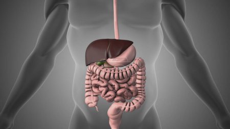 Medical animation showing gallstones in the gallbladder