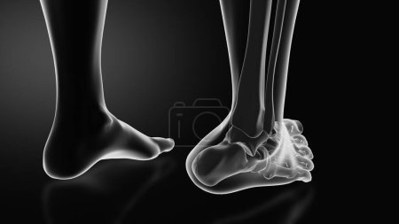 Photo for Ankle injury with dislocation and sprains - Royalty Free Image