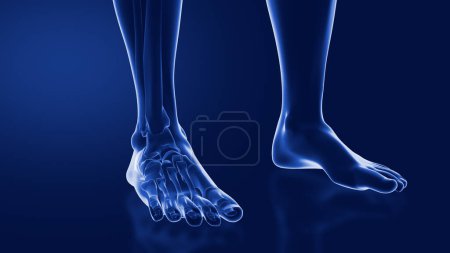 Photo for Sprains and dislocations to the ankle - Royalty Free Image
