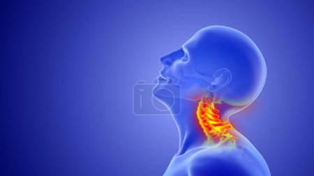 Téléchargez les photos : Mécanisme de coup de fouet dans les lésions cervicales de la colonne vertébrale ou du cou - en image libre de droit