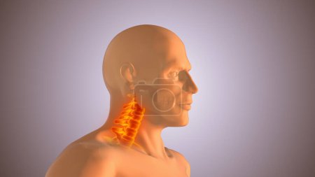 Téléchargez les photos : Lésions du cou ou de la colonne cervicale - en image libre de droit