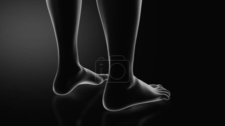 Photo for Metatarsalgia or Ball of Foot Pain - Royalty Free Image