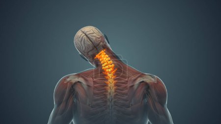 Photo for Medical animation for neck pain - Royalty Free Image