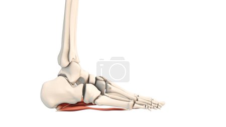 Photo for The medical animation of plantar fascia dysfunction - Royalty Free Image