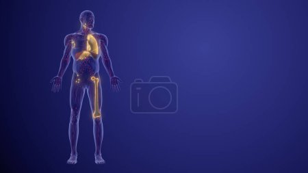 Photo for Lymphoma staging and prognosis medical animation - Royalty Free Image