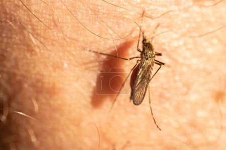 Inyección macro detallada de un mosquito en la piel humana, destacando la intrincada estructura corporal y los pelos finos del insecto. La imagen resalta la interacción del mosquito con la piel, mostrando sus alas y