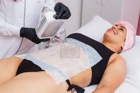 Foto de Aplicación de criolipólisis, crioterapia, preparándose para aplicar en el abdomen del paciente, con una sola placa del dispositivo de criolipólisis. paciente sonriendo - Imagen libre de derechos